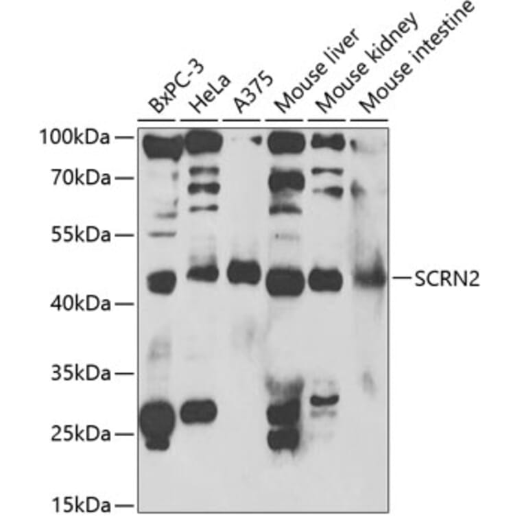 Western Blot - Anti-SCRN2 Antibody (A13374) - Antibodies.com