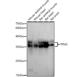 Western Blot - Anti-Tropomyosin 3 Antibody (A13375) - Antibodies.com