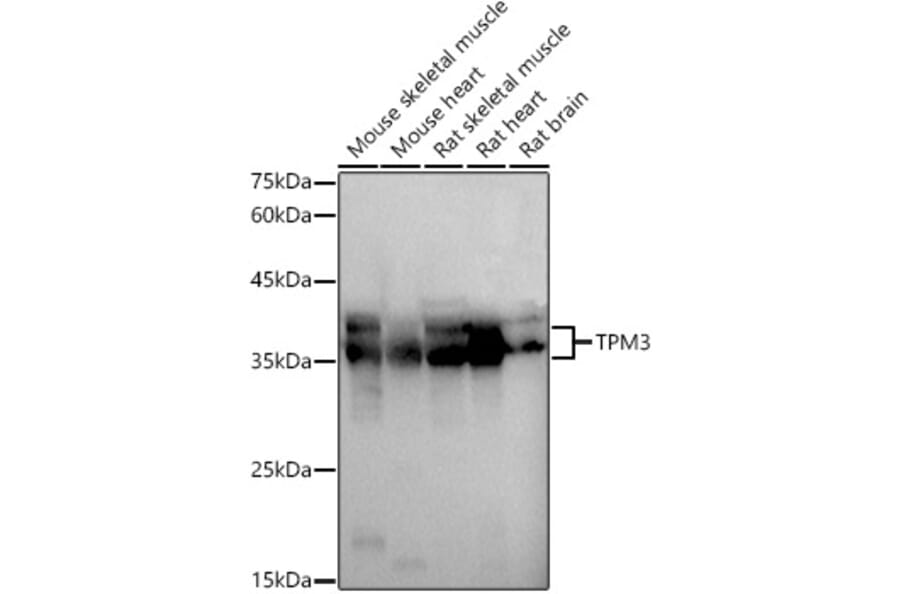 Western Blot - Anti-Tropomyosin 3 Antibody (A13375) - Antibodies.com
