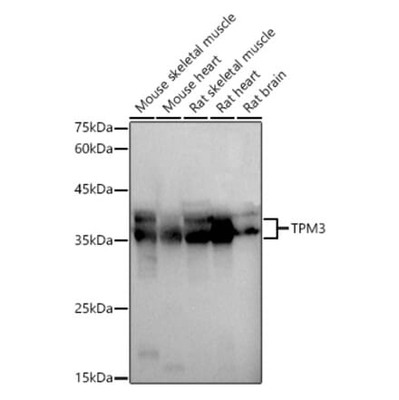 Western Blot - Anti-Tropomyosin 3 Antibody (A13375) - Antibodies.com