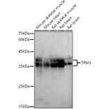 Western Blot - Anti-Tropomyosin 3 Antibody (A13375) - Antibodies.com