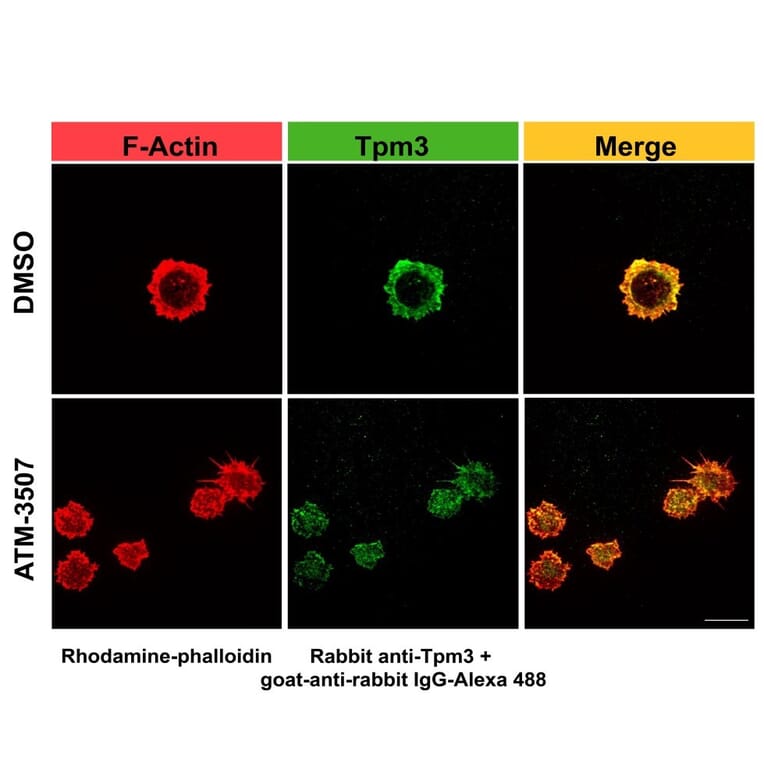 Immunofluorescence - Anti-Tropomyosin 3 Antibody (A13375) - Publication