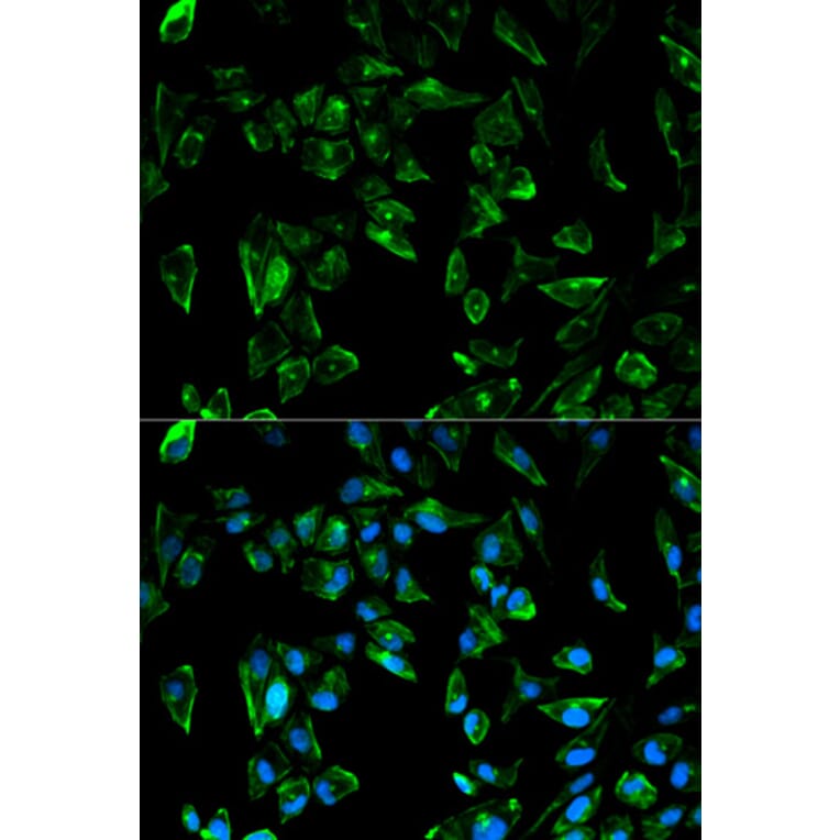 Immunofluorescence - Anti-Tropomyosin 3 Antibody (A13375) - Antibodies.com