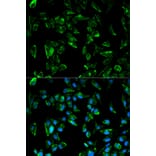 Immunofluorescence - Anti-Tropomyosin 3 Antibody (A13375) - Antibodies.com