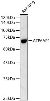 Western blot analysis of extracts of various cell lines, using Anti-ATP6AP1 Antibody (A1209) at 1:1,000 dilution.
Secondary antibody: Goat Anti-Rabbit IgG (H+L) (HRP) (AS014) at 1:10,000 dilution.
Lysates / proteins: 25µg per lane.
Blocking buffer: 3% non-fat dry milk in TBST.
