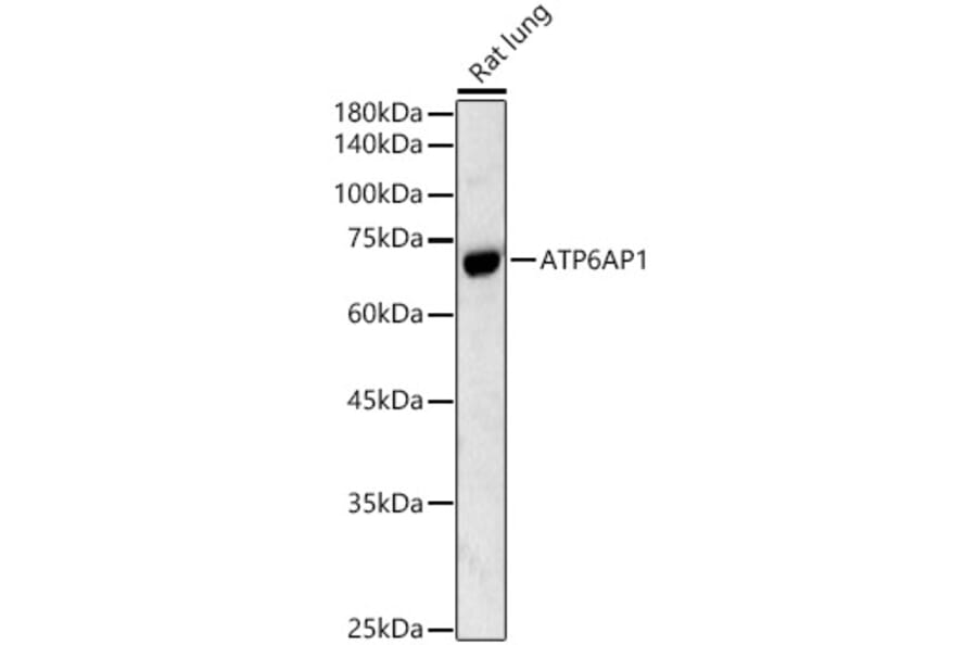 Western Blot - Anti-ATP6AP1/ATP6S1 Antibody (A13377) - Antibodies.com