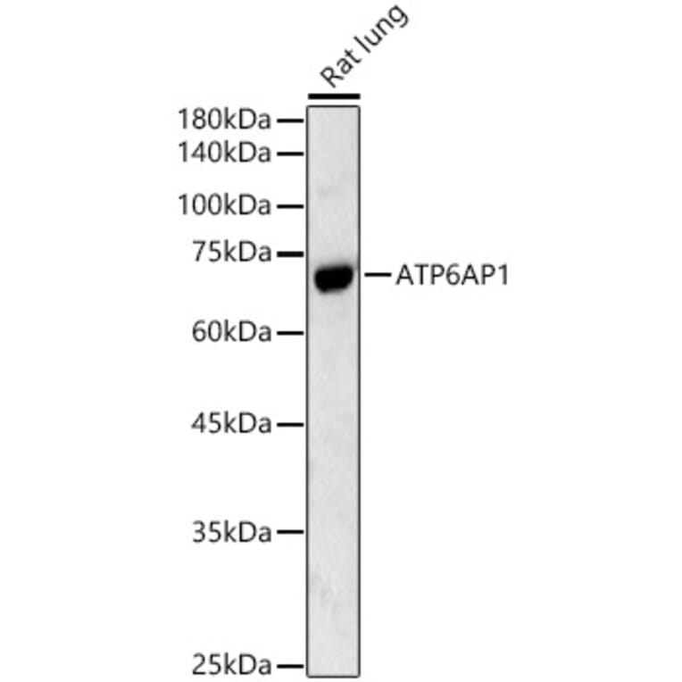 Western Blot - Anti-ATP6AP1/ATP6S1 Antibody (A13377) - Antibodies.com