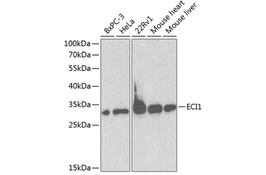 Western Blot - Anti-DCI Antibody (A13379) - Antibodies.com