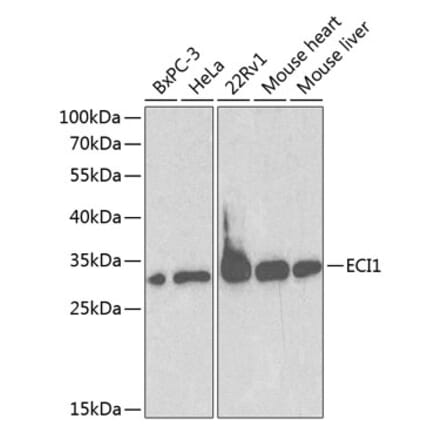 Western Blot - Anti-DCI Antibody (A13379) - Antibodies.com