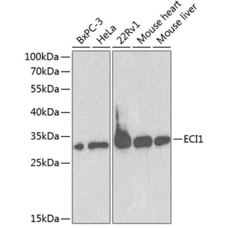 Western Blot - Anti-DCI Antibody (A13379) - Antibodies.com