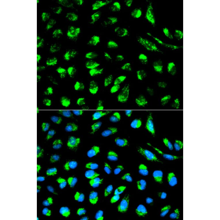 Immunofluorescence - Anti-DCI Antibody (A13379) - Antibodies.com