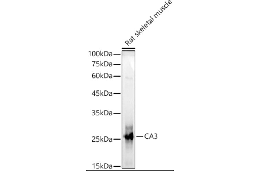 Western Blot - Anti-Carbonic Anhydrase 3/CA3 Antibody (A13380) - Antibodies.com