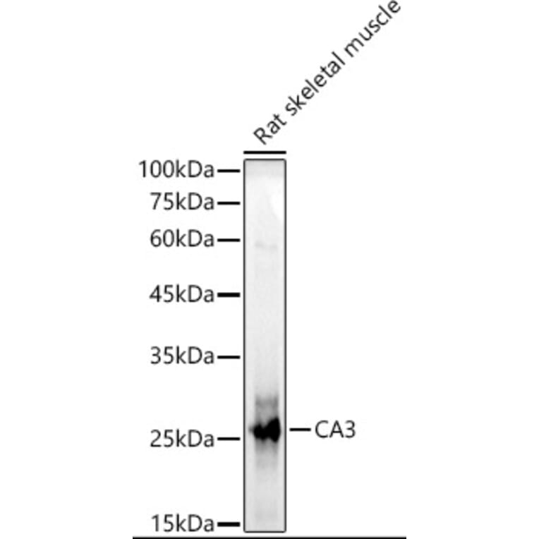 Western Blot - Anti-Carbonic Anhydrase 3/CA3 Antibody (A13380) - Antibodies.com