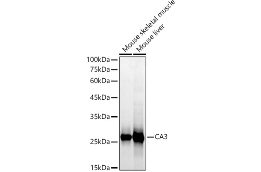 Western Blot - Anti-Carbonic Anhydrase 3/CA3 Antibody (A13380) - Antibodies.com