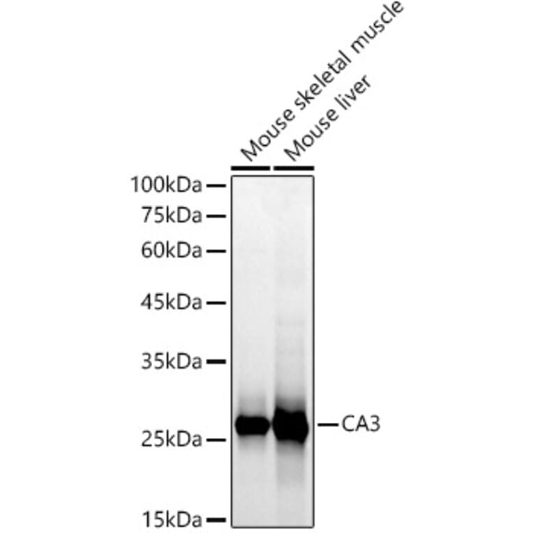Western Blot - Anti-Carbonic Anhydrase 3/CA3 Antibody (A13380) - Antibodies.com