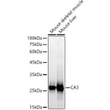 Western Blot - Anti-Carbonic Anhydrase 3/CA3 Antibody (A13380) - Antibodies.com