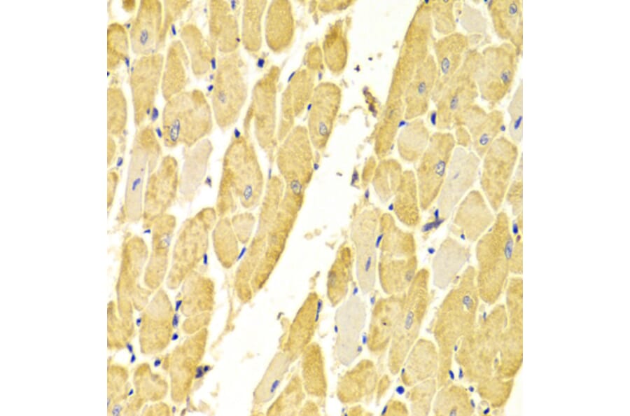 Immunohistochemistry - Anti-Carbonic Anhydrase 3/CA3 Antibody (A13380) - Antibodies.com