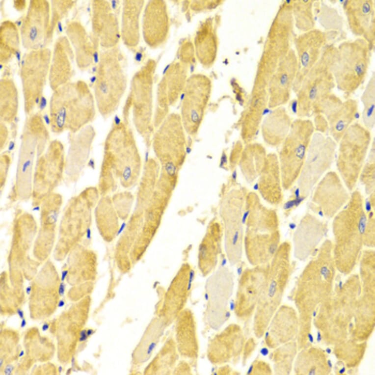 Immunohistochemistry - Anti-Carbonic Anhydrase 3/CA3 Antibody (A13380) - Antibodies.com