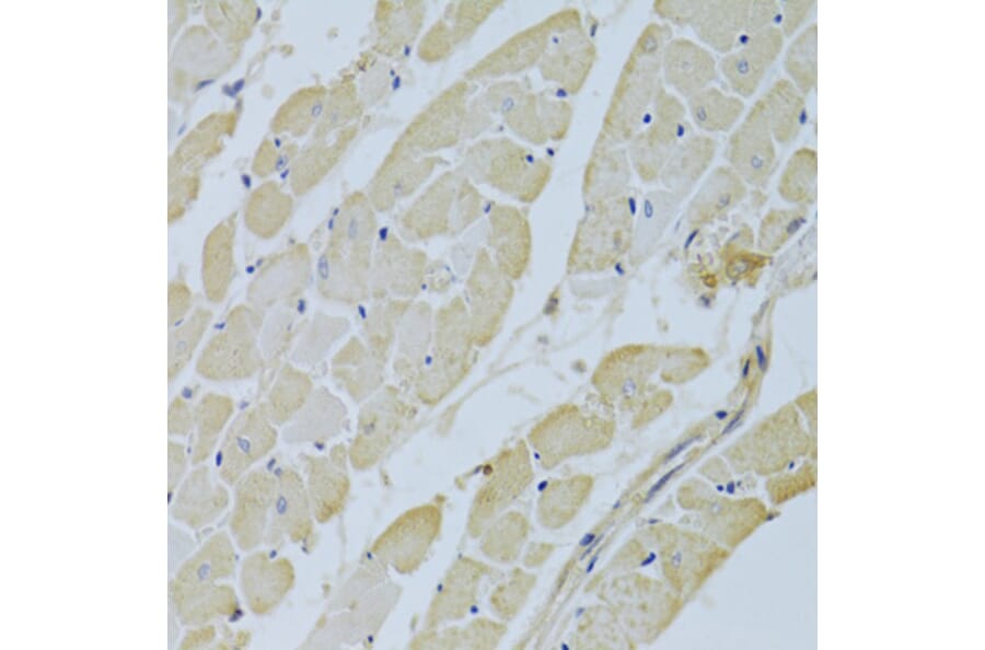Immunohistochemistry - Anti-Carbonic Anhydrase 3/CA3 Antibody (A13380) - Antibodies.com