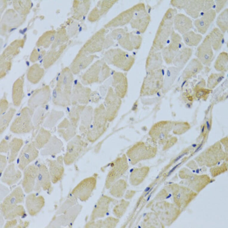Immunohistochemistry - Anti-Carbonic Anhydrase 3/CA3 Antibody (A13380) - Antibodies.com