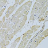 Immunohistochemistry - Anti-Carbonic Anhydrase 3/CA3 Antibody (A13380) - Antibodies.com