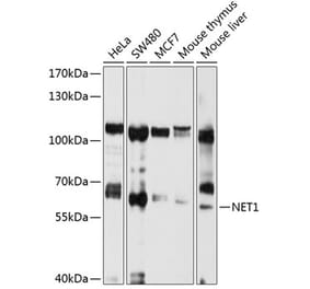 Western Blot - Anti-NET1 Antibody (A13381) - Antibodies.com