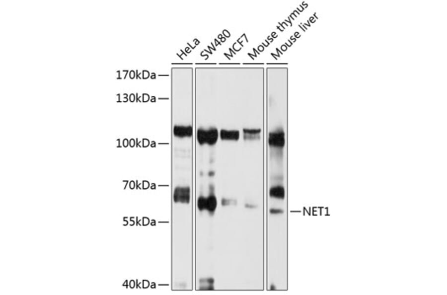 Western Blot - Anti-NET1 Antibody (A13381) - Antibodies.com