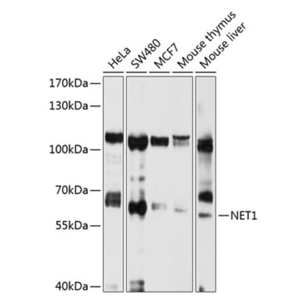 Western Blot - Anti-NET1 Antibody (A13381) - Antibodies.com