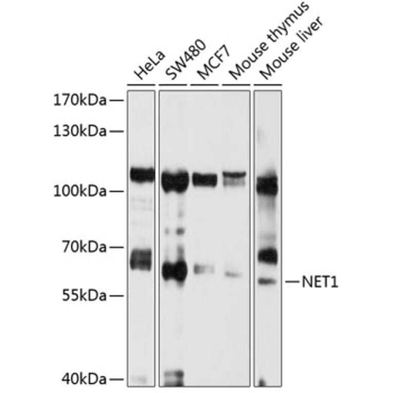 Western Blot - Anti-NET1 Antibody (A13381) - Antibodies.com