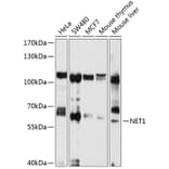 Western Blot - Anti-NET1 Antibody (A13381) - Antibodies.com