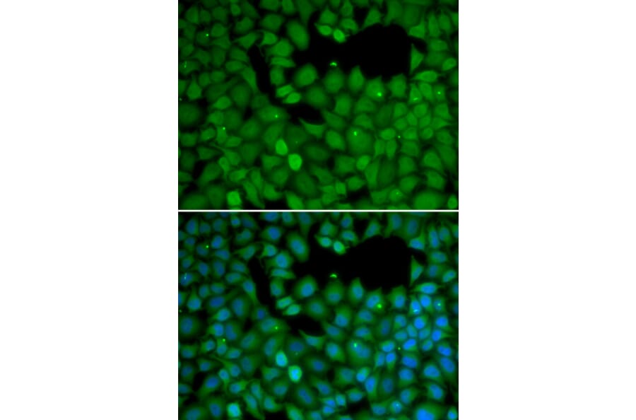 Immunofluorescence - Anti-NET1 Antibody (A13381) - Antibodies.com