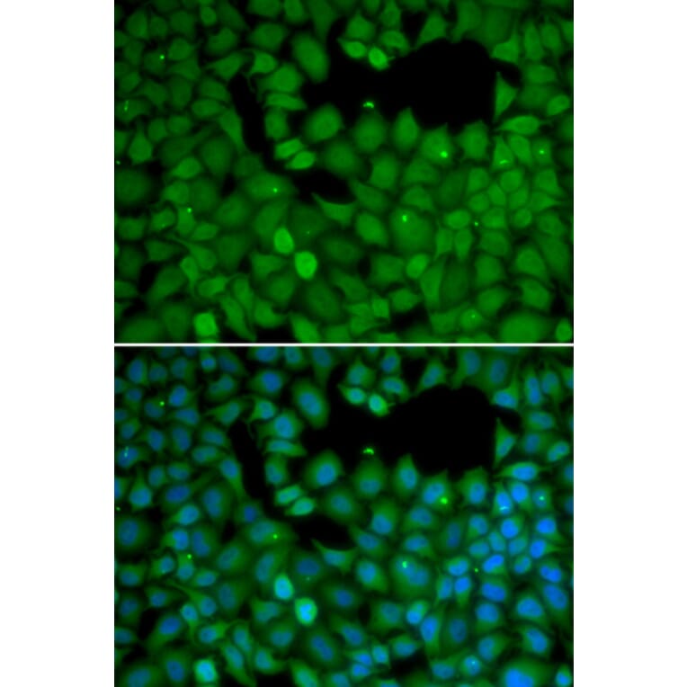 Immunofluorescence - Anti-NET1 Antibody (A13381) - Antibodies.com