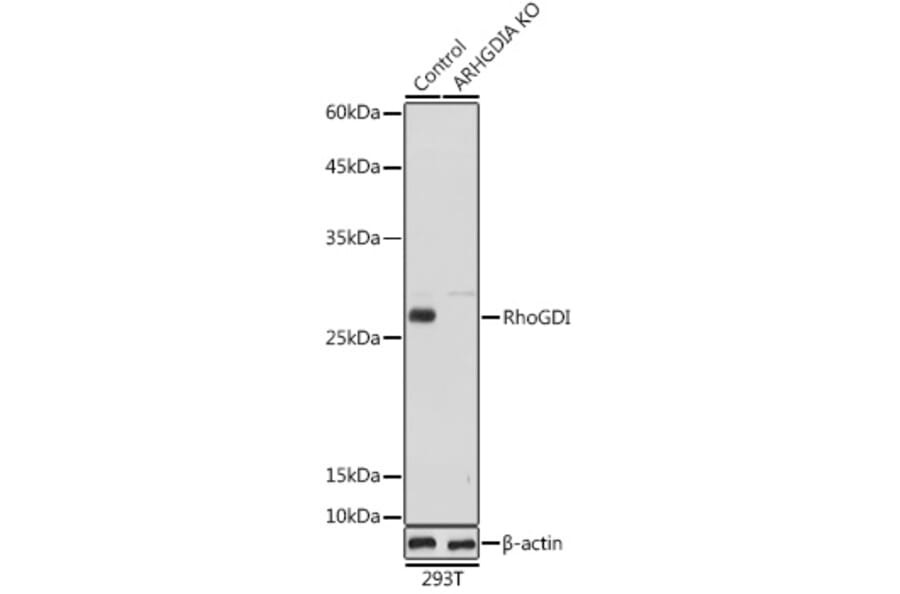 Western Blot - Anti-RhoGDI Antibody (A13382) - Antibodies.com