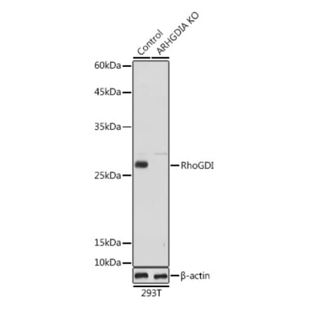 Western Blot - Anti-RhoGDI Antibody (A13382) - Antibodies.com