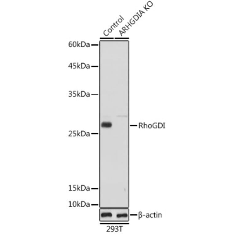 Western Blot - Anti-RhoGDI Antibody (A13382) - Antibodies.com