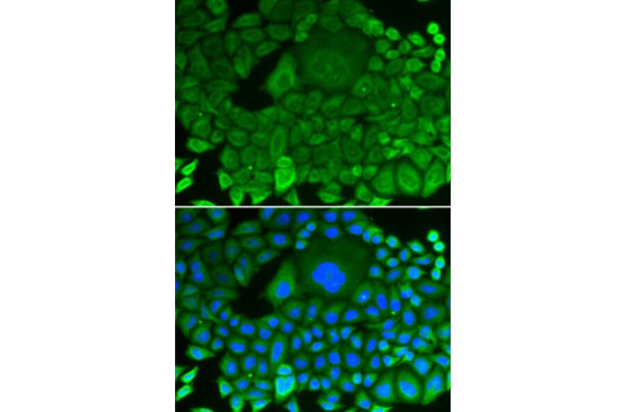 Immunofluorescence - Anti-RhoGDI Antibody (A13382) - Antibodies.com