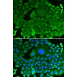 Immunofluorescence - Anti-RhoGDI Antibody (A13382) - Antibodies.com