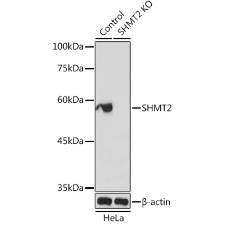Western Blot - Anti-SHMT2/SHMT Antibody (A13383) - Antibodies.com