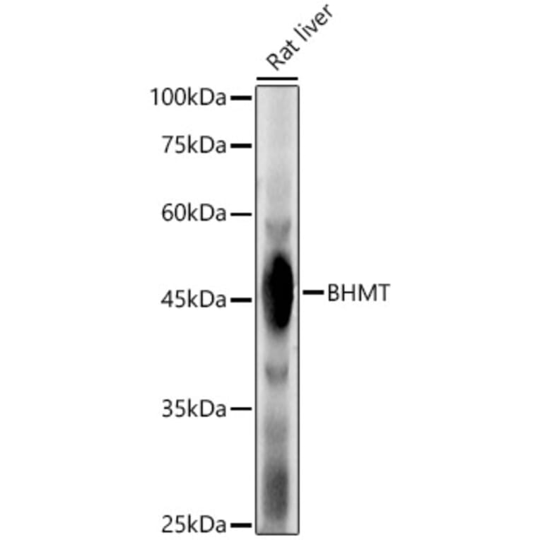 Western Blot - Anti-BHMT Antibody (A13384) - Antibodies.com