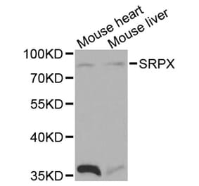 Western Blot - Anti-SRPX Antibody (A1217) - Antibodies.com