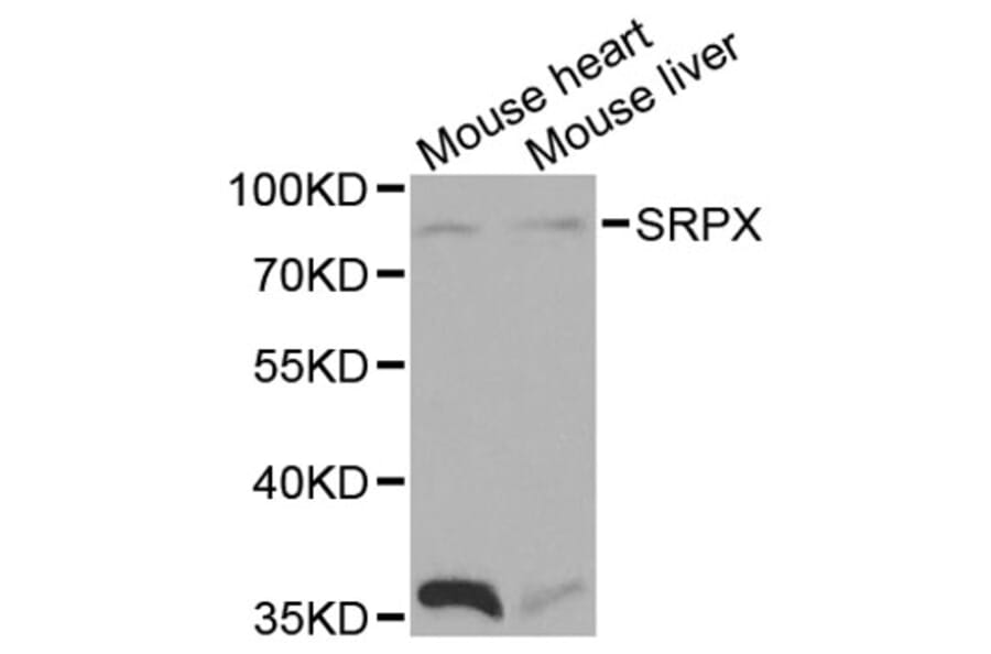 Western Blot - Anti-SRPX Antibody (A1217) - Antibodies.com