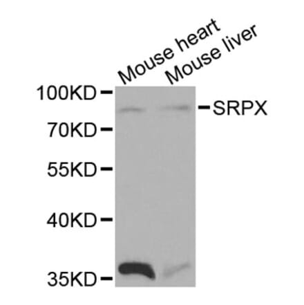 Western Blot - Anti-SRPX Antibody (A13385) - Antibodies.com