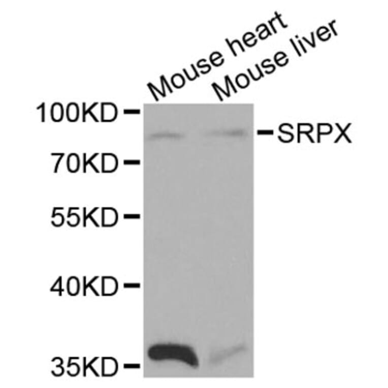 Western Blot - Anti-SRPX Antibody (A1217) - Antibodies.com