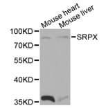 Western Blot - Anti-SRPX Antibody (A1217) - Antibodies.com