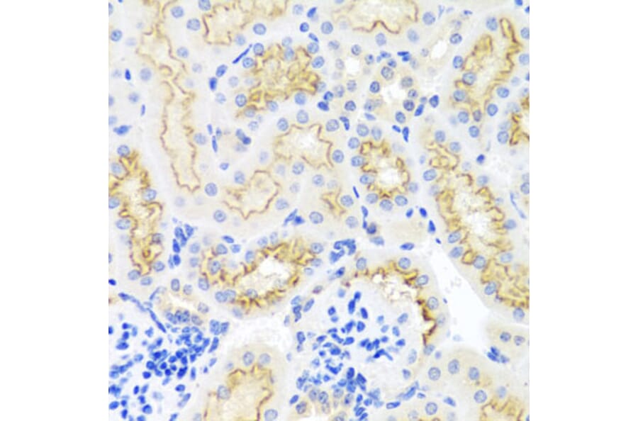 Immunohistochemistry - Anti-SRPX Antibody (A1217) - Antibodies.com