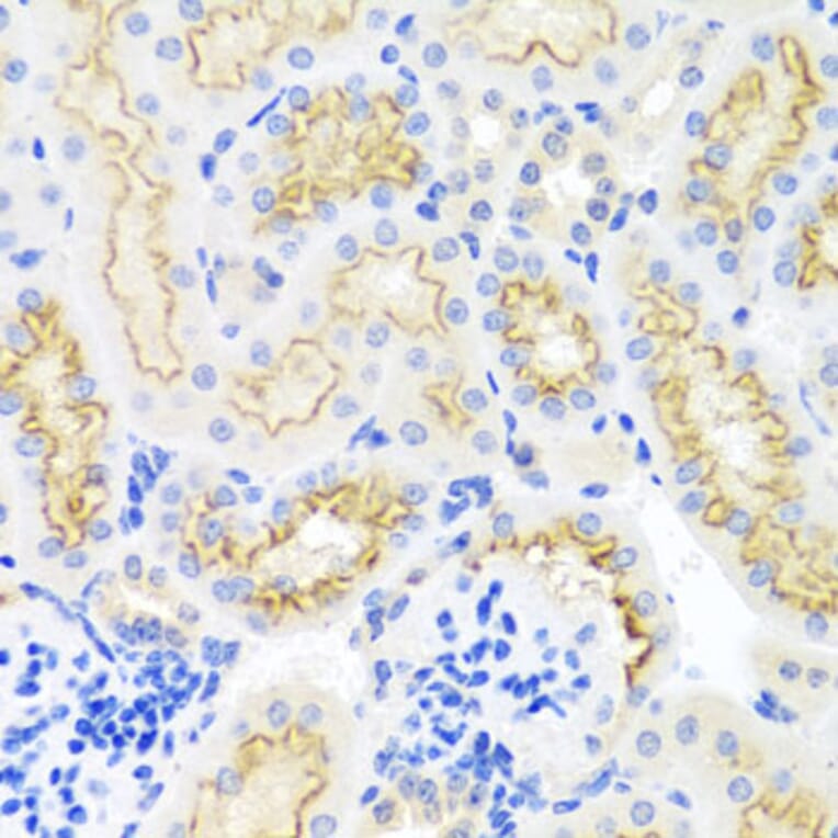 Immunohistochemistry - Anti-SRPX Antibody (A1217) - Antibodies.com