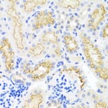 Immunohistochemistry - Anti-SRPX Antibody (A1217) - Antibodies.com