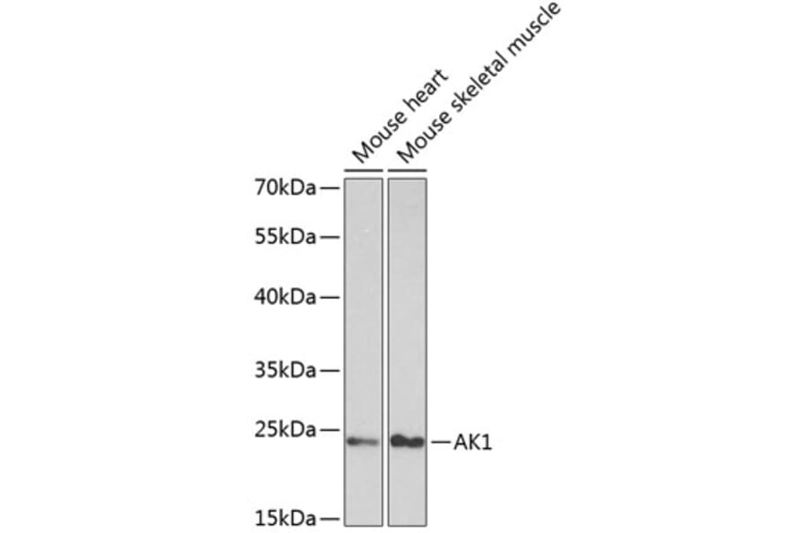 Western Blot - Anti-AK 1 Antibody (A13386) - Antibodies.com