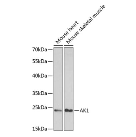 Western Blot - Anti-AK 1 Antibody (A13386) - Antibodies.com