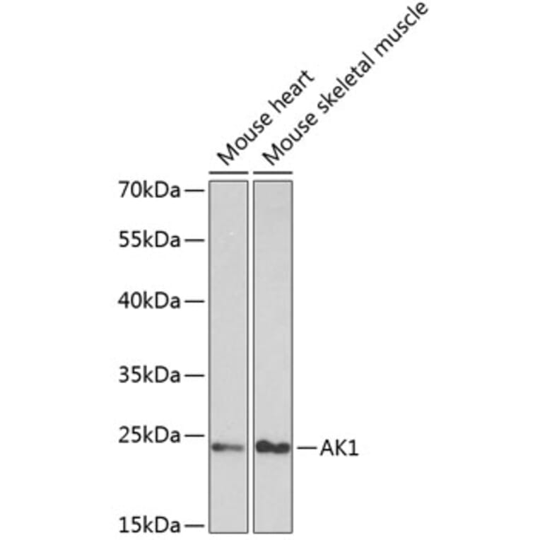 Western Blot - Anti-AK 1 Antibody (A13386) - Antibodies.com